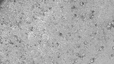 Blood Changes and Aging