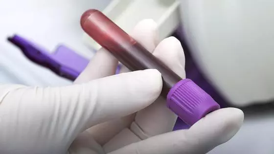 Blood Test